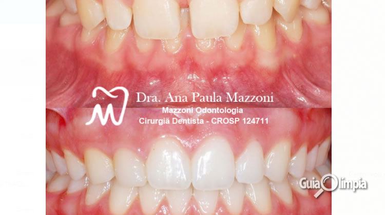 Mazzoni Odontologia
